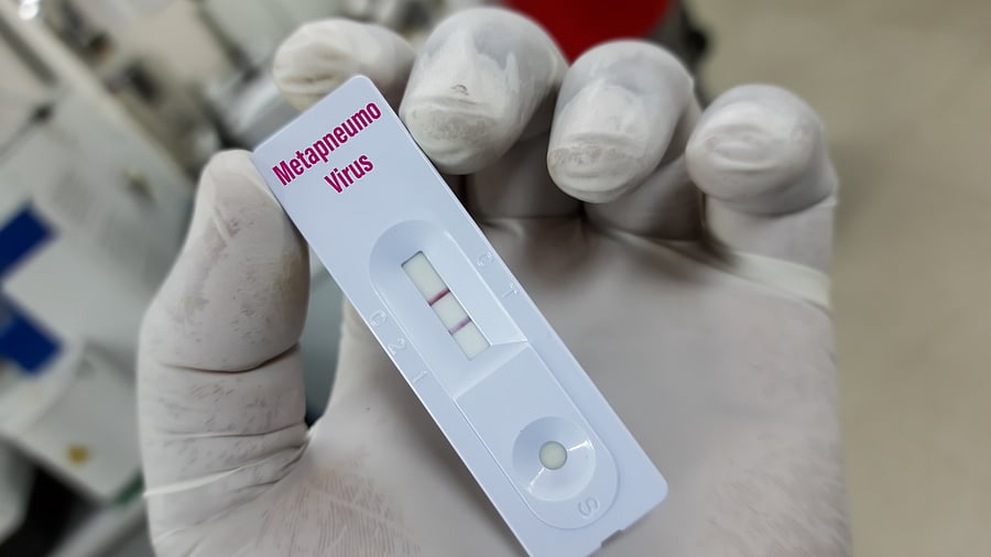 <div class="paragraphs"><p>Representative image showing a test for HMPV</p></div>