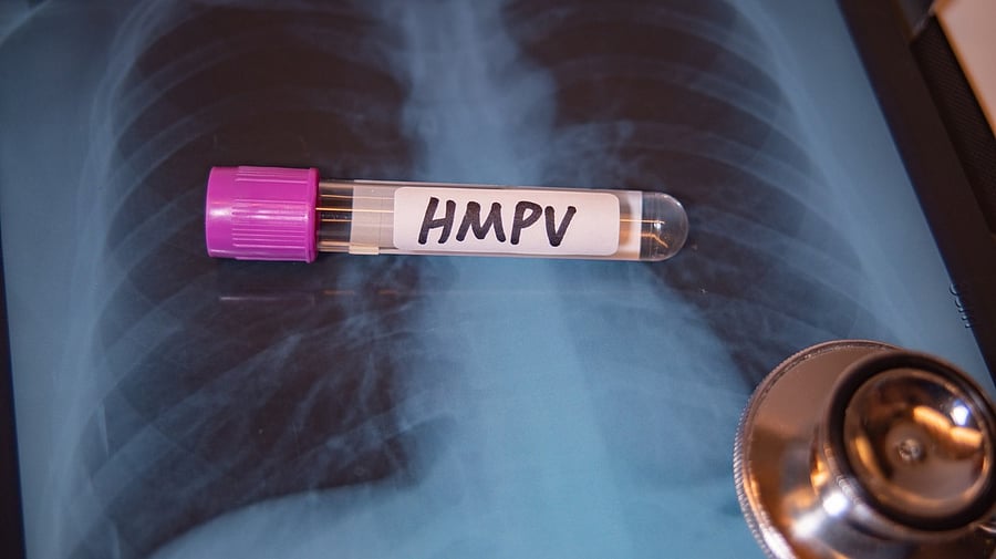 <div class="paragraphs"><p>Image for representational purpose</p></div>