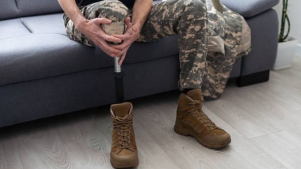 <div class="paragraphs"><p>Representative image of&nbsp;prosthetics.</p></div>