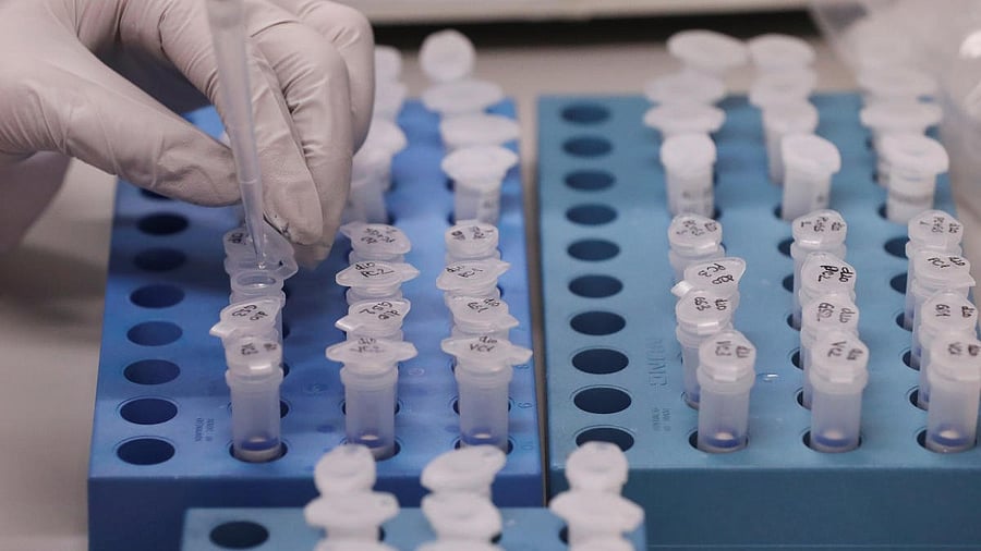 <div class="paragraphs"><p>Representative image. </p></div>