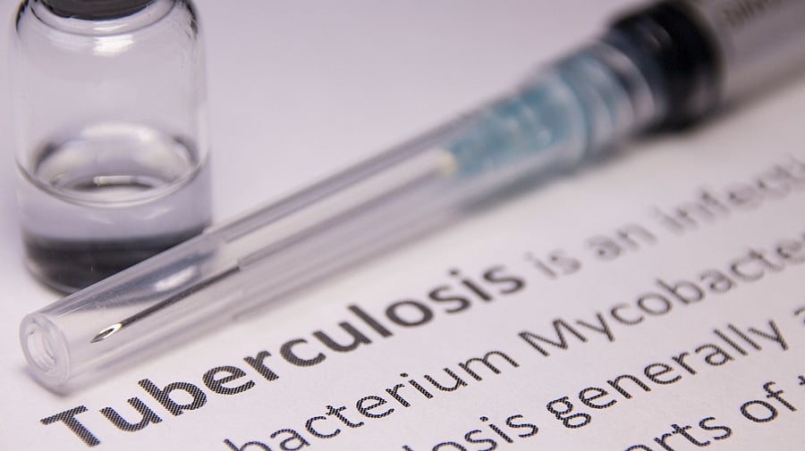 <div class="paragraphs"><p>Representative image showing the word&nbsp;tuberculosis</p></div>