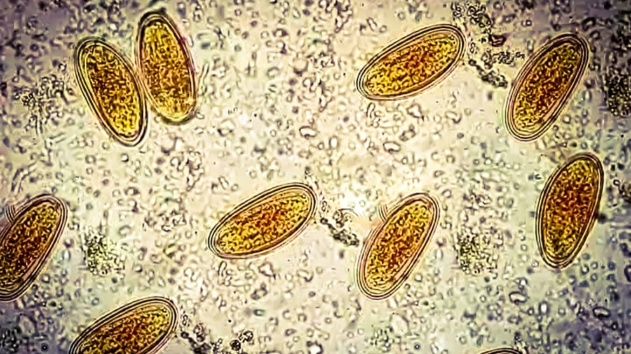 <div class="paragraphs"><p>Representative image showing parasites under a microscope.</p></div>