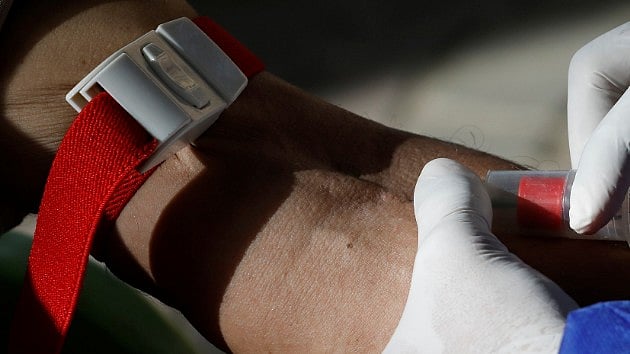 <div class="paragraphs"><p>The process, which takes roughly 30 minutes from drawing the blood to diagnosis, will be available to patients at a fraction of the cost of a PET scan.</p></div>