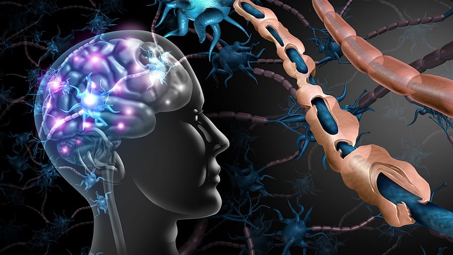 <div class="paragraphs"><p>Stakeholders call for more awareness to navigate multiple sclerosis challenges</p></div>