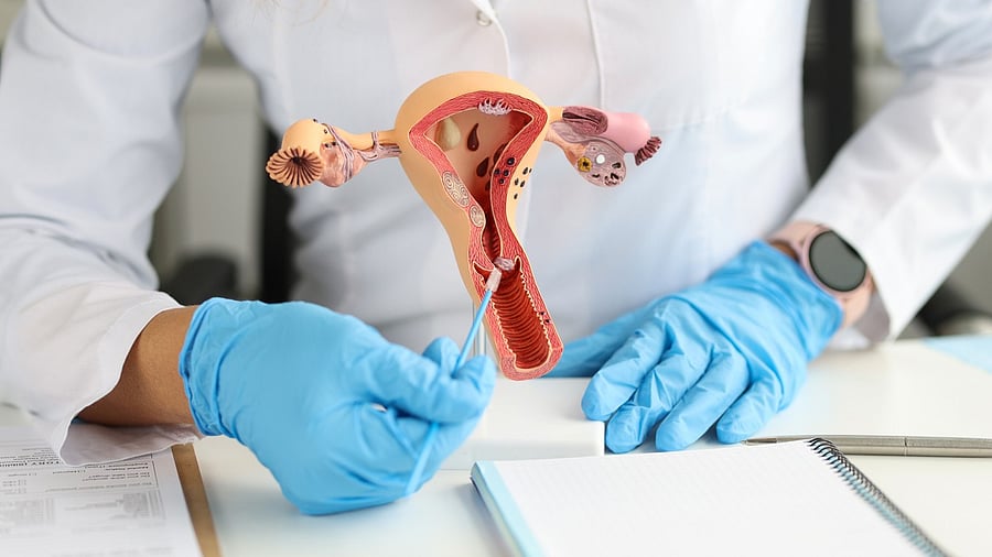 <div class="paragraphs"><p>Representative image showing female&nbsp;reproductive system.</p></div>