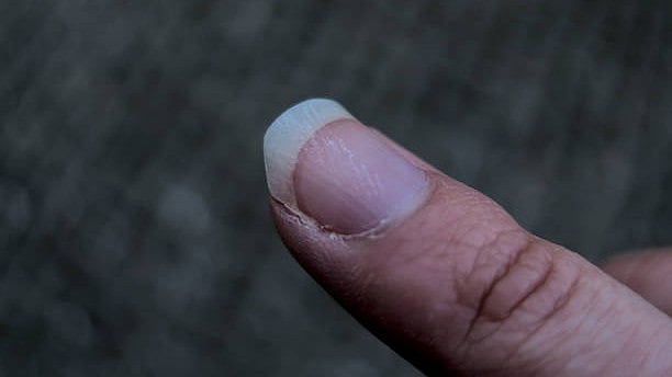 <div class="paragraphs"><p>Image for representational purposes.</p></div>