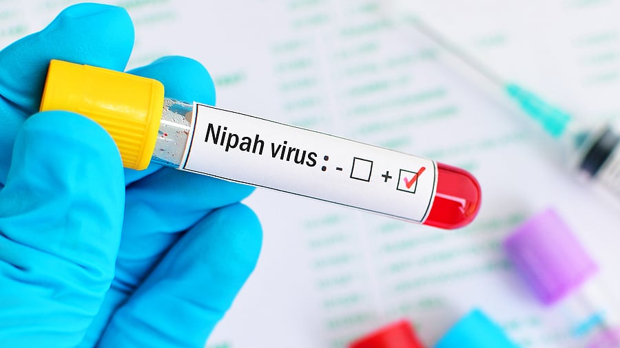 <div class="paragraphs"><p>A vial with 'Nipah virus' written on it. Image for representation.</p></div>