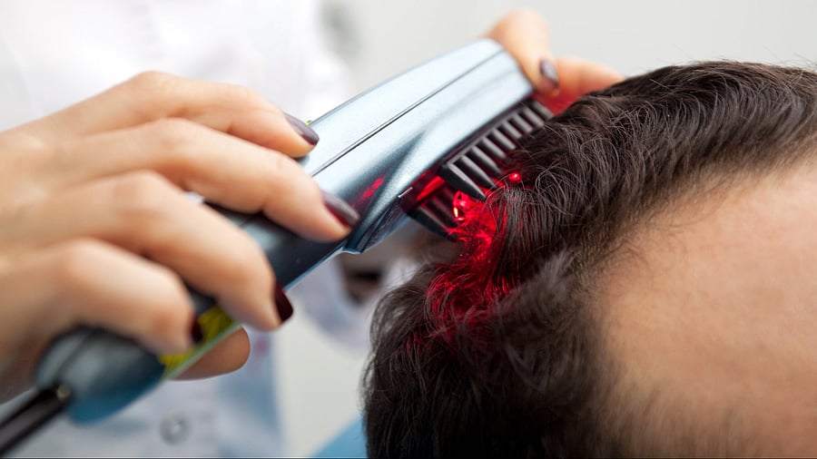 Dermatologists from Bengaluru say they get a lot of clients with hair growth treatments gone wrong.