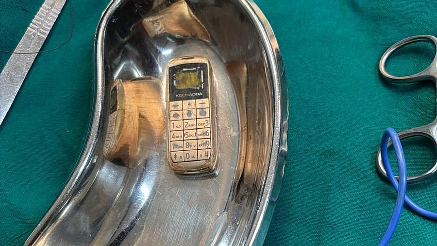 <div class="paragraphs"><p>The mobile phone removed from the stomach of&nbsp;Daulat Khan alias Gunda, an inmate of Central Jail, Shivamogga.&nbsp;</p></div>
