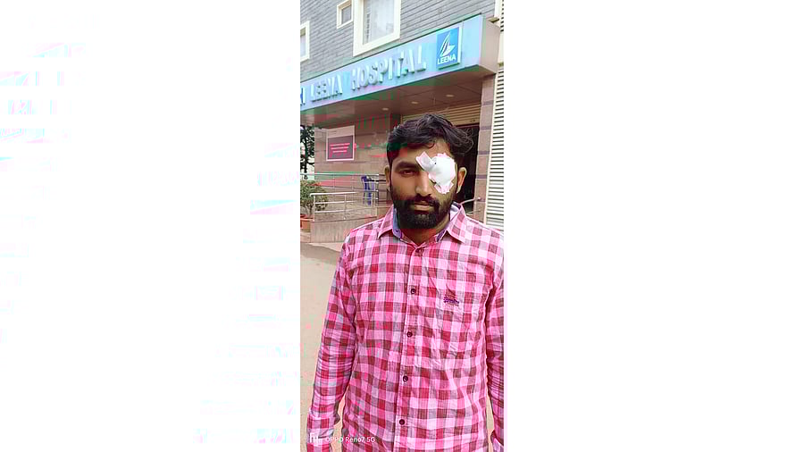 <div class="paragraphs"><p>Pramod Kumar (34), who lost partial sight in his left eye during a protest against land acquisition in Devanahalli taluk.</p></div>