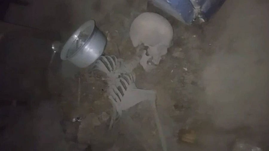<div class="paragraphs"><p>Hyderabad man shockingly finds human skeleton</p></div>