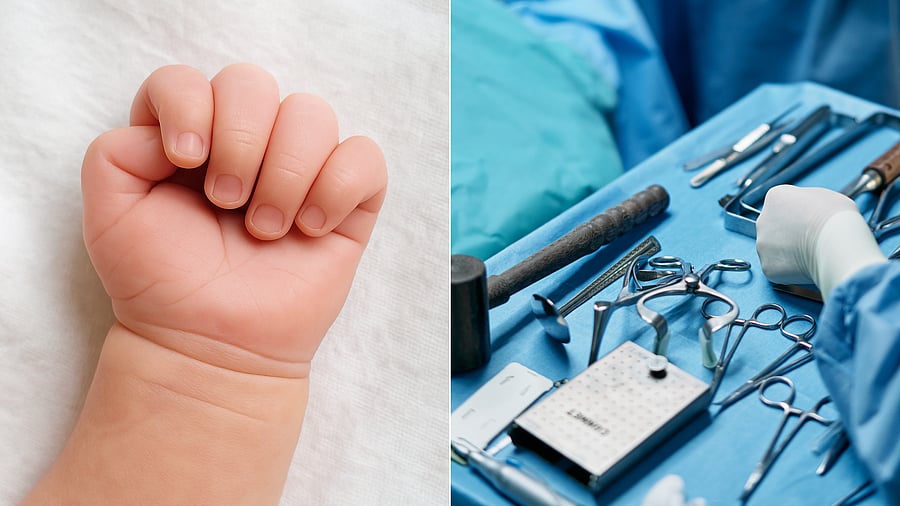 <div class="paragraphs"><p>Representative Image</p></div>