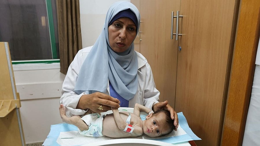 <div class="paragraphs"><p>A nurse examines a malnourished child, according to medics, at Nasser Hospital in Khan Younis, southern Gaza Strip, July 25, 2025.</p></div>