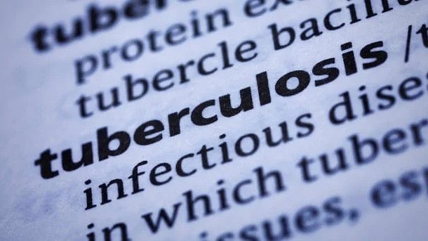 <div class="paragraphs"><p>The risk of TB transmission to household contacts is a little more when the case in the family is sputum smear positive. </p></div>