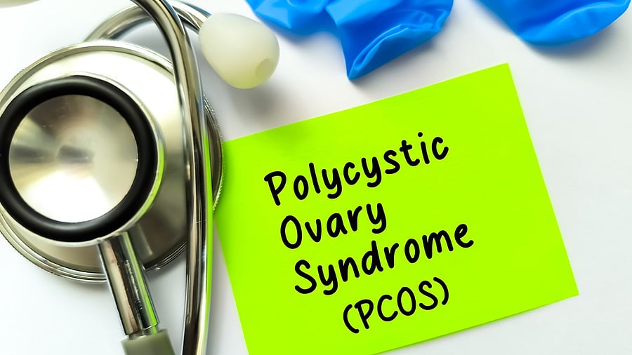 <div class="paragraphs"><p>PCOS or Polycystic ovary syndrome.</p></div>