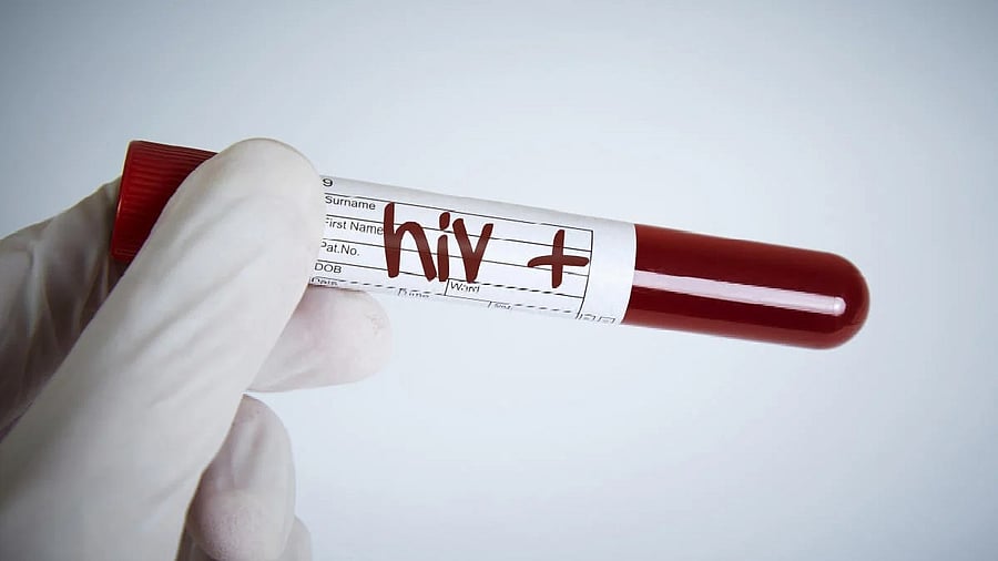 <div class="paragraphs"><p>HIV positive blood sample  </p></div>
