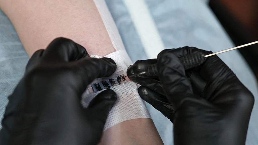 <div class="paragraphs"><p>Representative image of tattooing.</p></div>