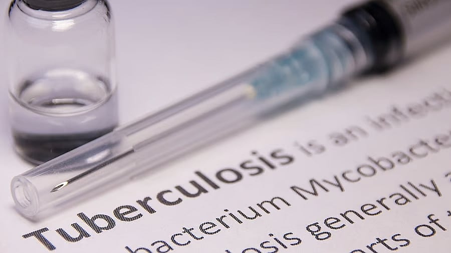 <div class="paragraphs"><p>Representative image showing the word tuberculosis.</p></div>