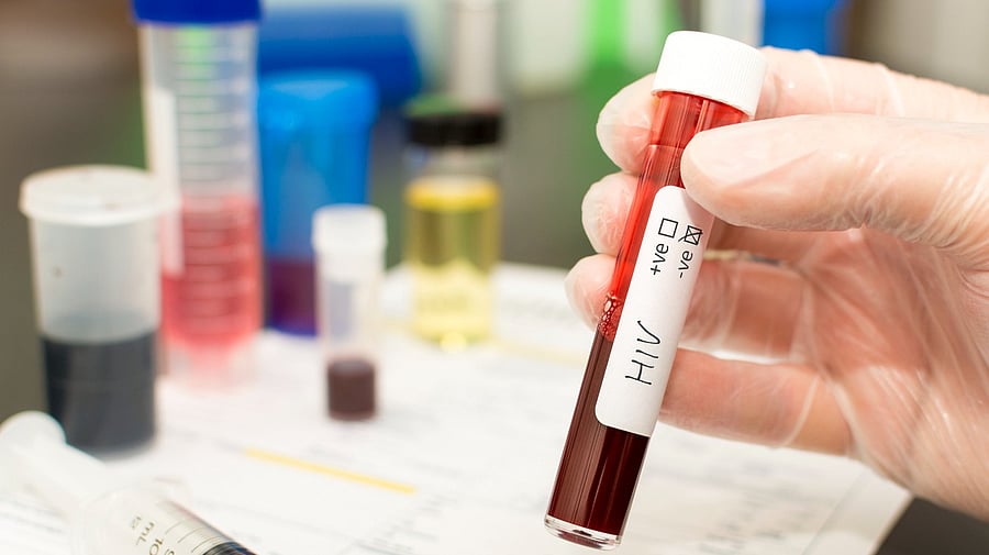 <div class="paragraphs"><p>Lives of HIV+ people bloom with disciplined routine, early treatment </p></div>