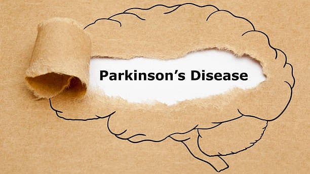 <div class="paragraphs"><p>Representative image for Parkinson’s disease.</p></div>