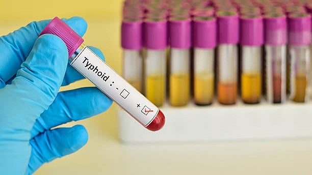 <div class="paragraphs"><p>Image for representational purposes.</p></div>