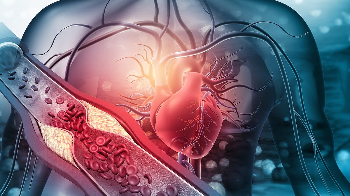 Bengaluru Sees Alarming Rise in Atherosclerosis Among Young Adults, Doctors Issue Warning