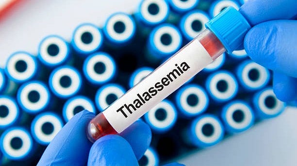 Thalassemia Patients Demand Job Quotas Under Disabilities Act in Karnataka