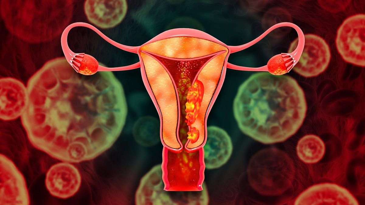 Period blood can help trace this notoriously difficult condition to ...