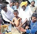 Canine Fury: Victims of a dog attack in Chokkasandra show their wounds . DH Photo