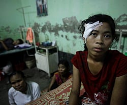 Hla Hla Myint, a victim of recent violence with a head gunshot wound, rests in a bed at a hospital in Kyuktaw township October 25, 2012. Hundreds of homes burned and gunfire rang out as sectarian violence raged for a fifth day between Rohingya Muslims and Buddhists in western Myanmar on Thursday, pushing the death toll to nearly 60 and testing the country's nascent democracy. Picture taken October 25, 2012. REUTERS