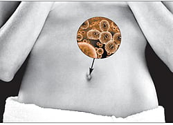 Navel has bacterias similar to those found in rainforest