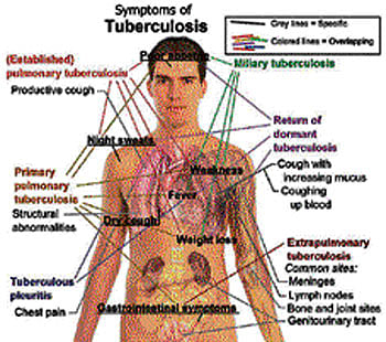 File photo for representation