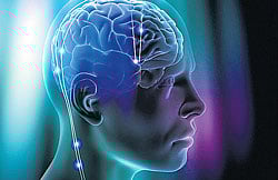 It is believed to work by stimulating a specific area of the brain to reverse abnormalities linked to mood, anxiety, emotional control, obsessions and compulsions all of which are common in anorexia.