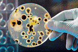 Do-gooders: The body builds up its supply of good bacteria naturally, but it also possible through probiotics. (Photo: Getty Images)