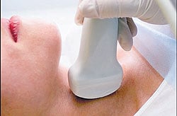 Thyroid and infertility