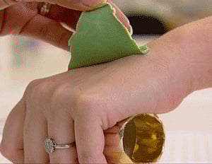 This undated handout photo provided by the Annals of Internal Medicine shows a demonstration of how a silicon cast is applied to the back of the hand so researchers can measure fine lines in the skin. . If worry about skin cancer doesn't make you slop on sunscreen, maybe vanity will: New research provides some of the strongest evidence to date that near-daily sunscreen use can slow the aging of your skin. The new study, from Australia's Sunshine Coast, used a unique step to measure whether sunscreens really help that constant onslaught. Researchers compared fine lines on the hands of hundreds of people who, for more than four years, had been assigned to rub on sunscreen daily or only when they deemed it necessary. AP Photo