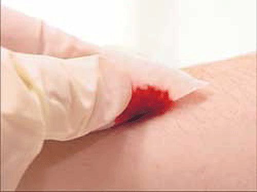 File image: Only for representational purpose