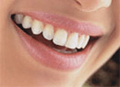 For representational purpose