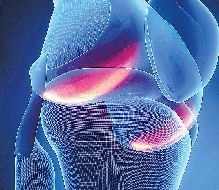 Costs an arm and a leg