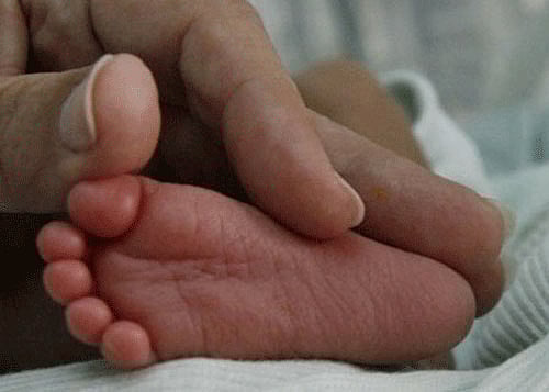 Pictorial Representation Only