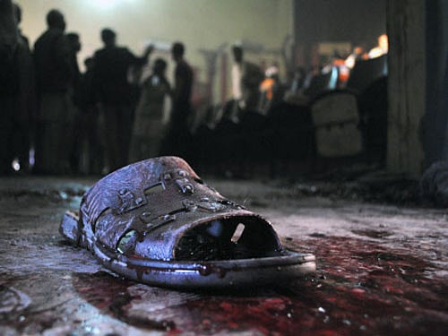 A 42-year-old doctor has been mercilessly beaten to death allegedly by three youths, after the victim had protested harassing of his daughter by the accused in the district's Inchauli area, police said today. AP File Photo. For Representation Only.