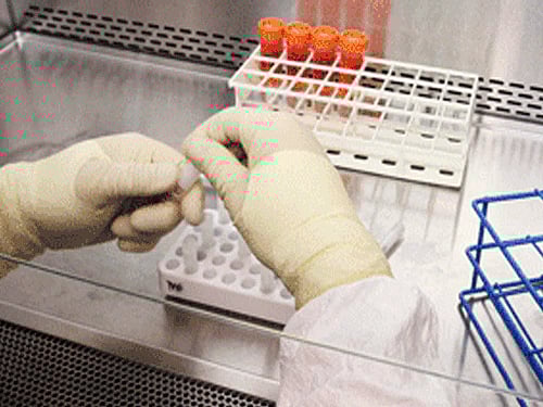 Japanese researchers have successfully implanted lab-grown retinal tissue from induced pluripotent stem cells (iPS) into a woman in her 70s - the world s first recipient of stem cells. Reuetrs file photo