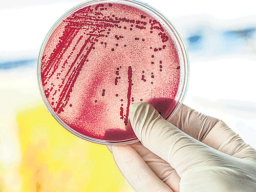 Our microbes have probably adapted to our lifestyles.