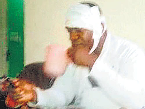 One of the Africans injured in the attack.