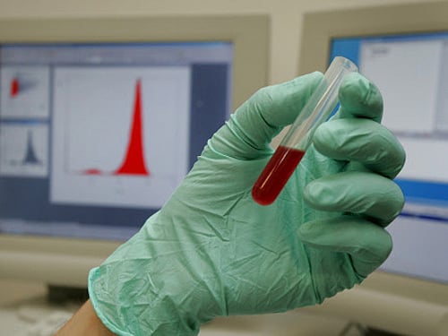 The researchers discovered that an enzyme called fidgetin-like 2 (FL2) puts the brakes on skin cells as they migrate towards wounds to heal them. DH file photo