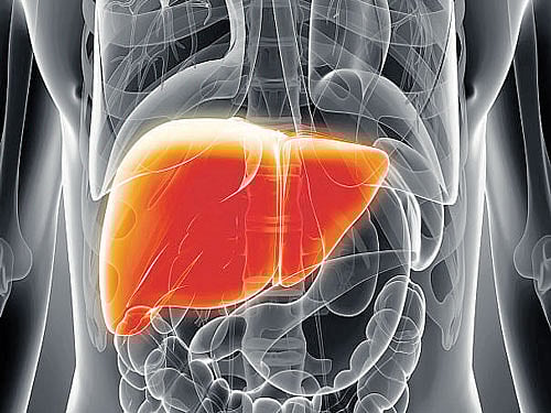 Representation image