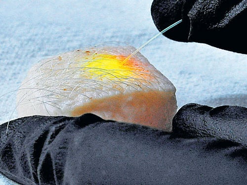 nascent An optical fibre is shown activating tiny lasers within pig cells.