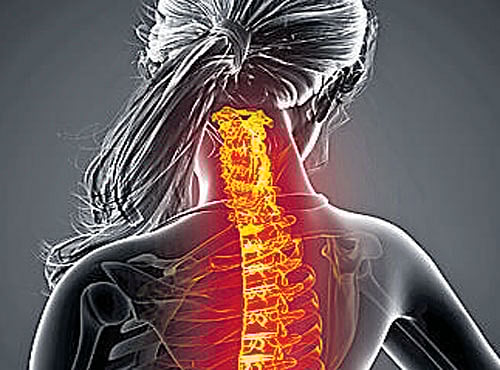 Researchers, writing in the August issue of The Journal of Paediatrics, did magnetic imaging studies that measured fat, muscle and bone in 70 healthy full-term newborns, 35 of them girls. DH illustration