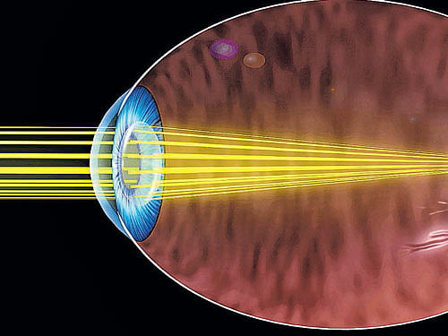 light inside The cells within the eye emit biophotons.