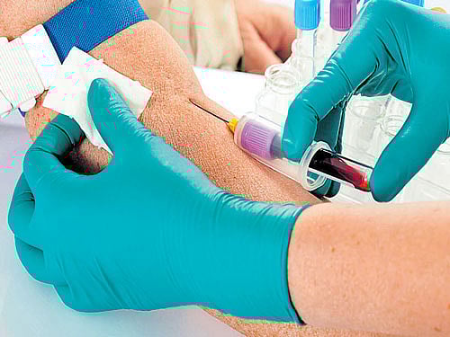 Based on an analysis of 10,000 individuals, researchers have identified a molecular byproduct of inflammation, called GlycA, which seems to predict premature death due to infections. DH file photo. For representation purpose